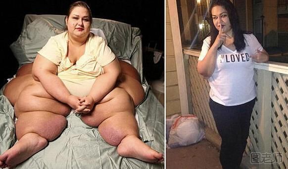 1000斤女子狂甩720多斤 盘点肥胖的危害