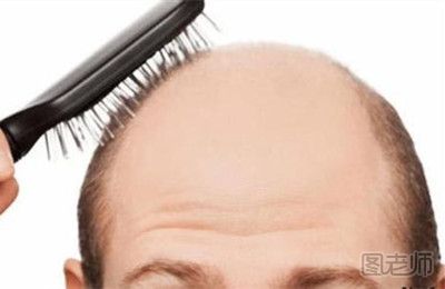 头发稀疏怎么办 头发稀疏怎么处理