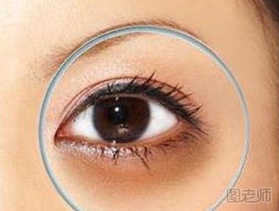 黑眼圈怎么去除 去除黑眼圈的方法有哪些