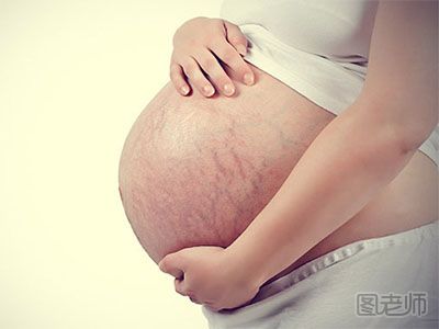 孕妇肚皮痒的原因有哪些 孕妇肚皮痒是怎么回事