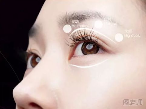 双眼皮埋线如何护理 双眼皮埋线术后护理方法