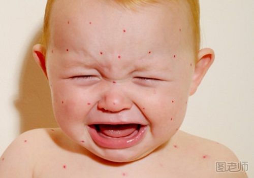 宝宝湿疹护理误区有哪些 宝宝湿疹护理注意事项