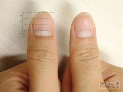 指甲上的月牙代表什么,手指甲上的月牙代表什