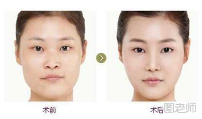 大脸变小脸的化妆技巧 教你怎么化妆显脸小