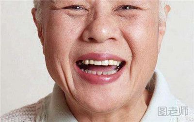 老人误吞假牙险至食管穿孔 老人佩戴假牙要注意什么