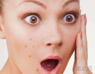 毛孔堵塞导致长痘的原因以及护理方法