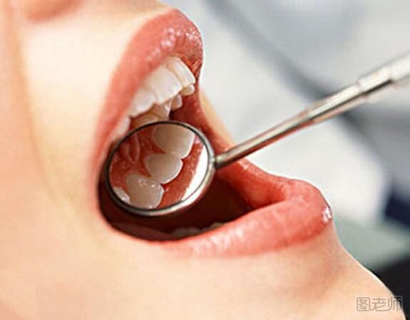洗牙对牙齿有伤害吗 洗牙后的注意事项