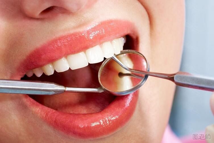 洗牙对牙齿有伤害吗 洗牙后的注意事项