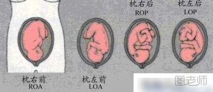 胎方位roa是什么意思