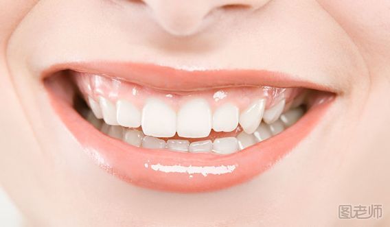 牙齿发黄怎么办 如何恢复牙齿洁白
