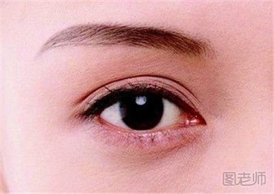 双眼皮手术有哪几种 双眼皮手术要注意什么
