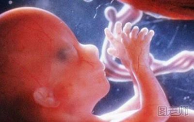 胎儿畸形有什么症状 胎儿畸形分几种