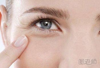 眼角纹如何有效去除 注意这些日常坏习惯
