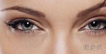 欧式双眼皮有什么特点？
