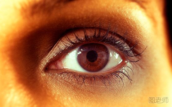 日常消除黑眼圈的小妙招 黑眼圈有哪几种