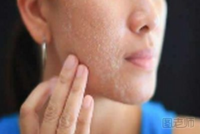 抹完护肤品脸上黏黏的怎么办