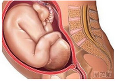 胎儿脐带要注意的问题 当心胎儿的脐带危机1.png