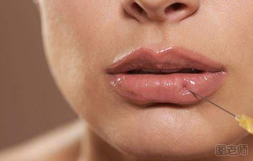 玻尿酸隆鼻要注意什么 玻尿酸丰唇多久能消肿