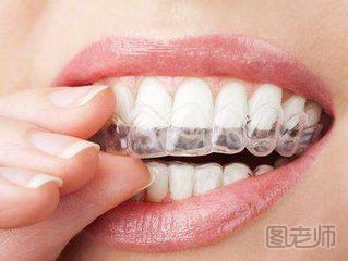 矫正牙齿期间应该注意些什么