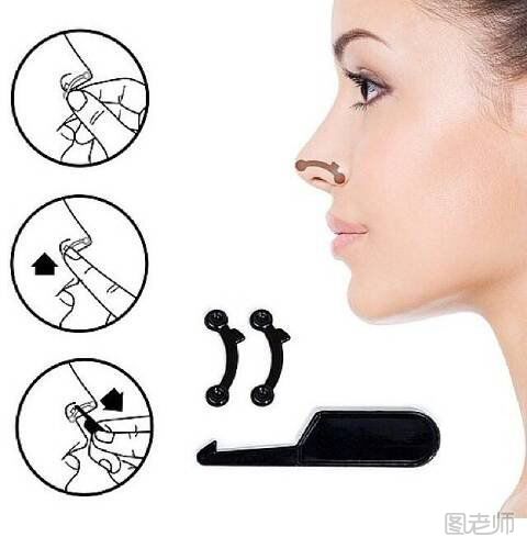 让鼻子变挺的方法鼻挺器