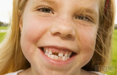 【图】换牙期间要怎么护理,小孩几岁开始换牙