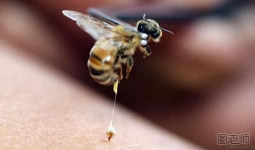 被蜜蜂蜇了怎么消肿？被蜜蜂蜇了不能吃什么？