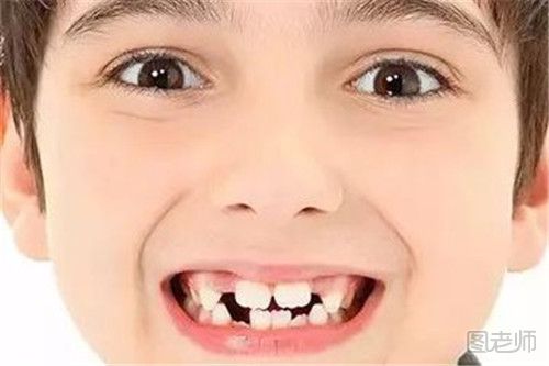 孩子换牙期间不小心吞食了乳牙怎么办