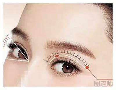 双眼皮隐形切开法是什么 双眼皮切开法的步骤有哪些