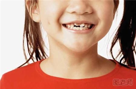 换牙期间的注意事项    换牙期怎样护理