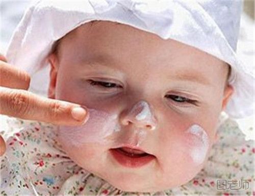 冬季孩子脸部皮肤皲裂如何预防