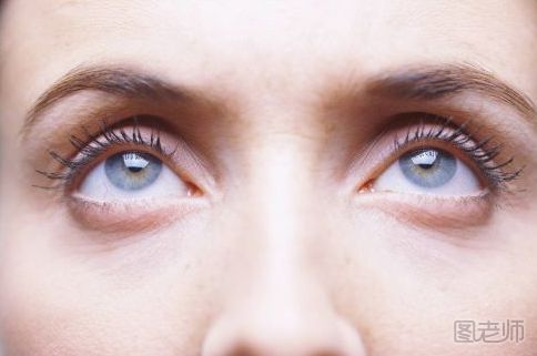 激光溶脂去眼袋能保持多久 激光溶脂去眼袋有什么危害