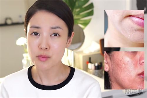 如何抵抗粉尘对皮肤的危害 粉尘皮肤怎么修复