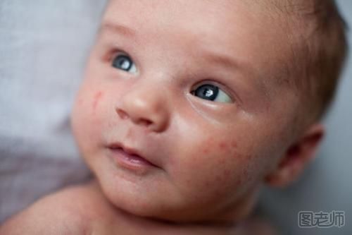 预防宝宝奶粉过敏的最佳方案