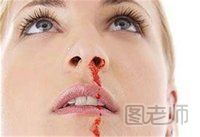 怀孕流鼻血是什么原因