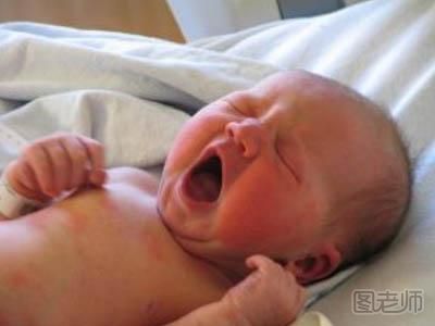 新生儿吸入综合征 新生儿吸入综合征护理