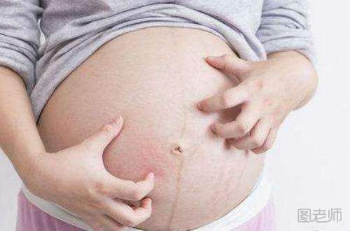 孕妇皮肤过敏怎么办