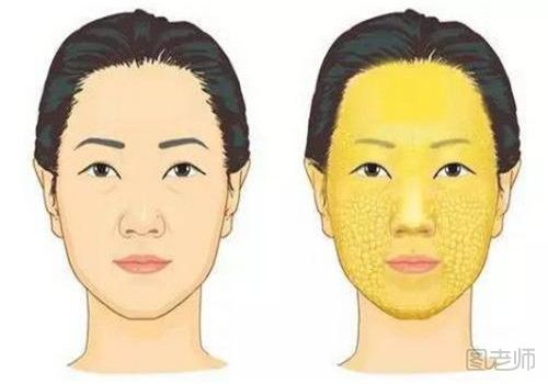 面部吸脂是什么 手术的方法
