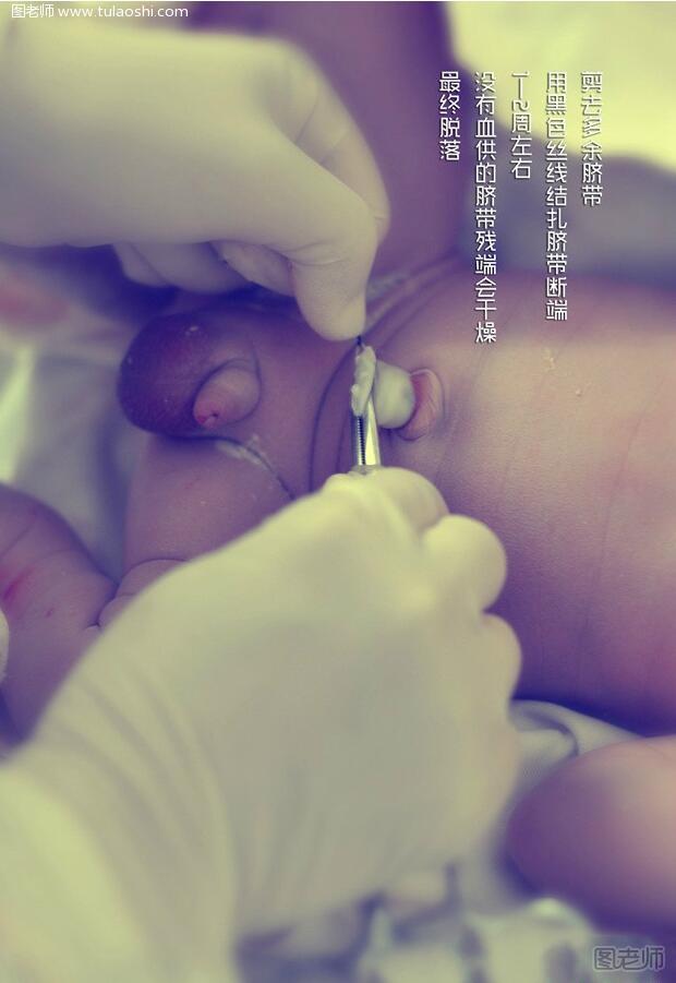 剖宫产过程